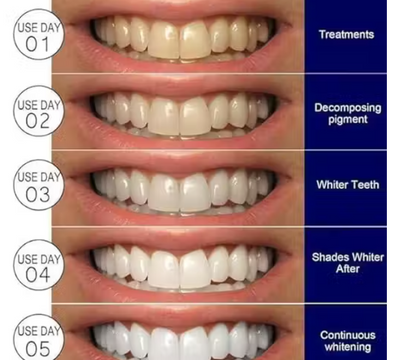 LustraGlow™ 5-Day Smile Enhancer – Enamel-Safe Whitening Strips for Instant Brightening, Non-Sensitive Formula